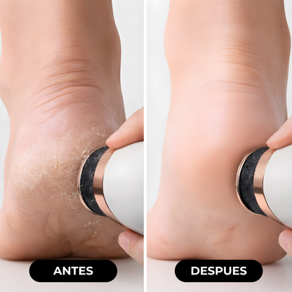 Kit Eléctrico Removedor de Callos para Pies